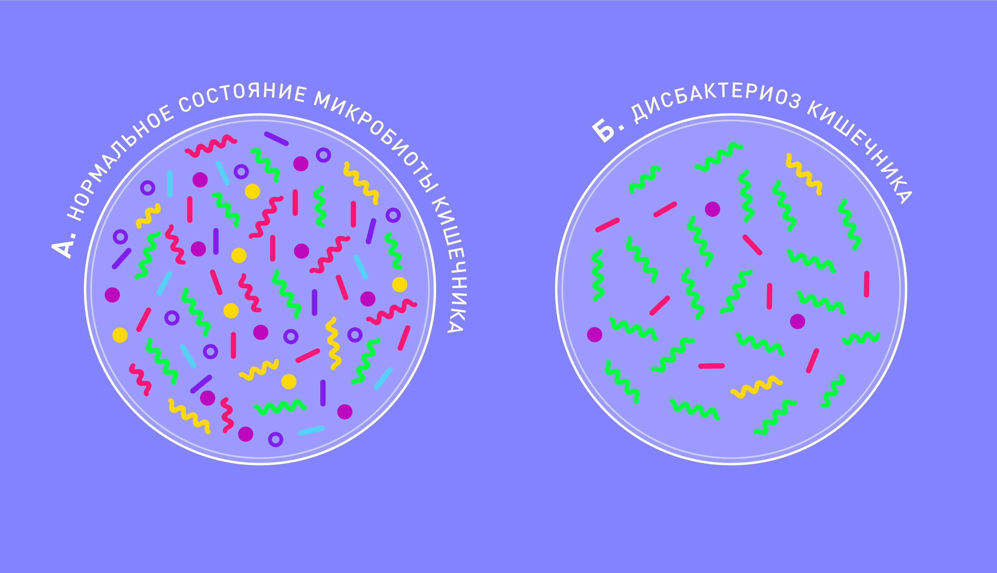 Дисбактериоз кишечника: симптомы, причины, состояние микробиоты